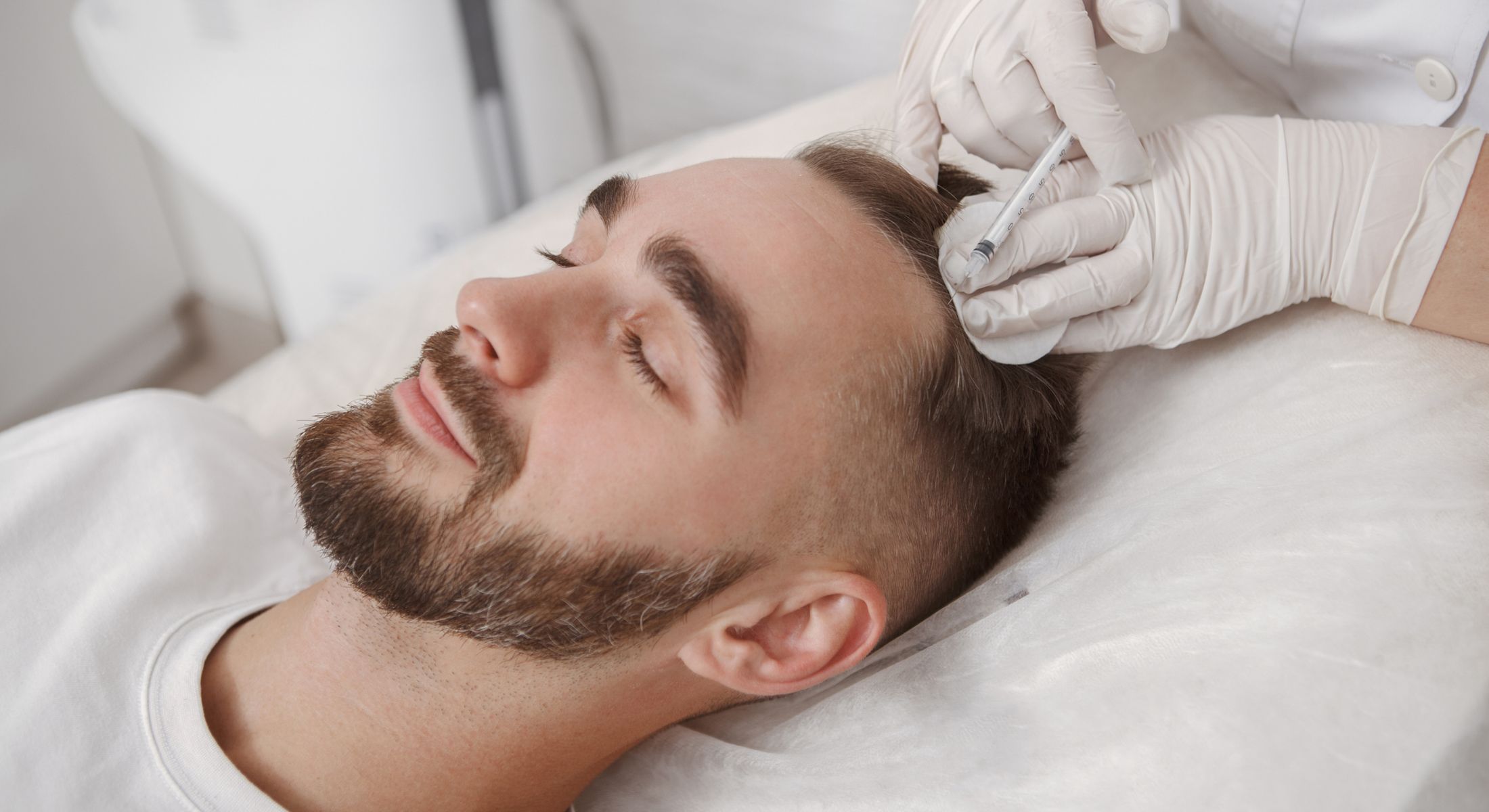 San Francisco prp hair restoration model receiving treatment